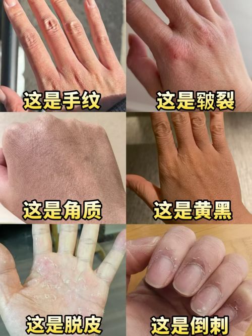 榜推荐排行榜十款公认好用的护手霜OG网站2025年）护手霜排行(图15)